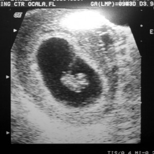 baby boy C baby boy C