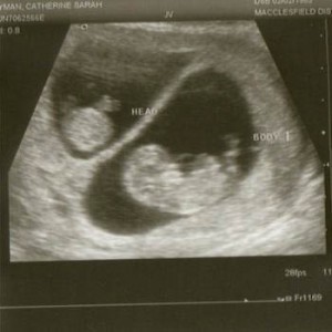 baby twins N baby twins N