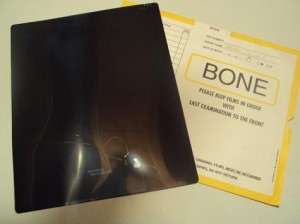 Bone x-ray 010