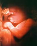 A baby at 18 weeks