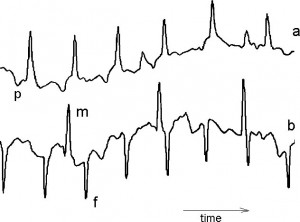Fetal heartbeats