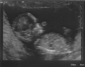 Hans and Katy's number 4!