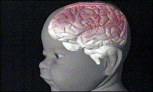 Baby brain